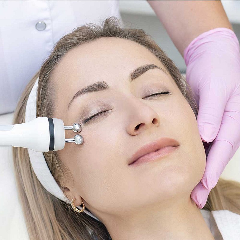 Радиочестотен лифтинг за лице